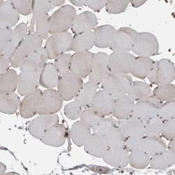 Ataxin-2 Antibody, Novus Biologicals 0.1mL; Unlabeled:Antibodies, Polyclonal